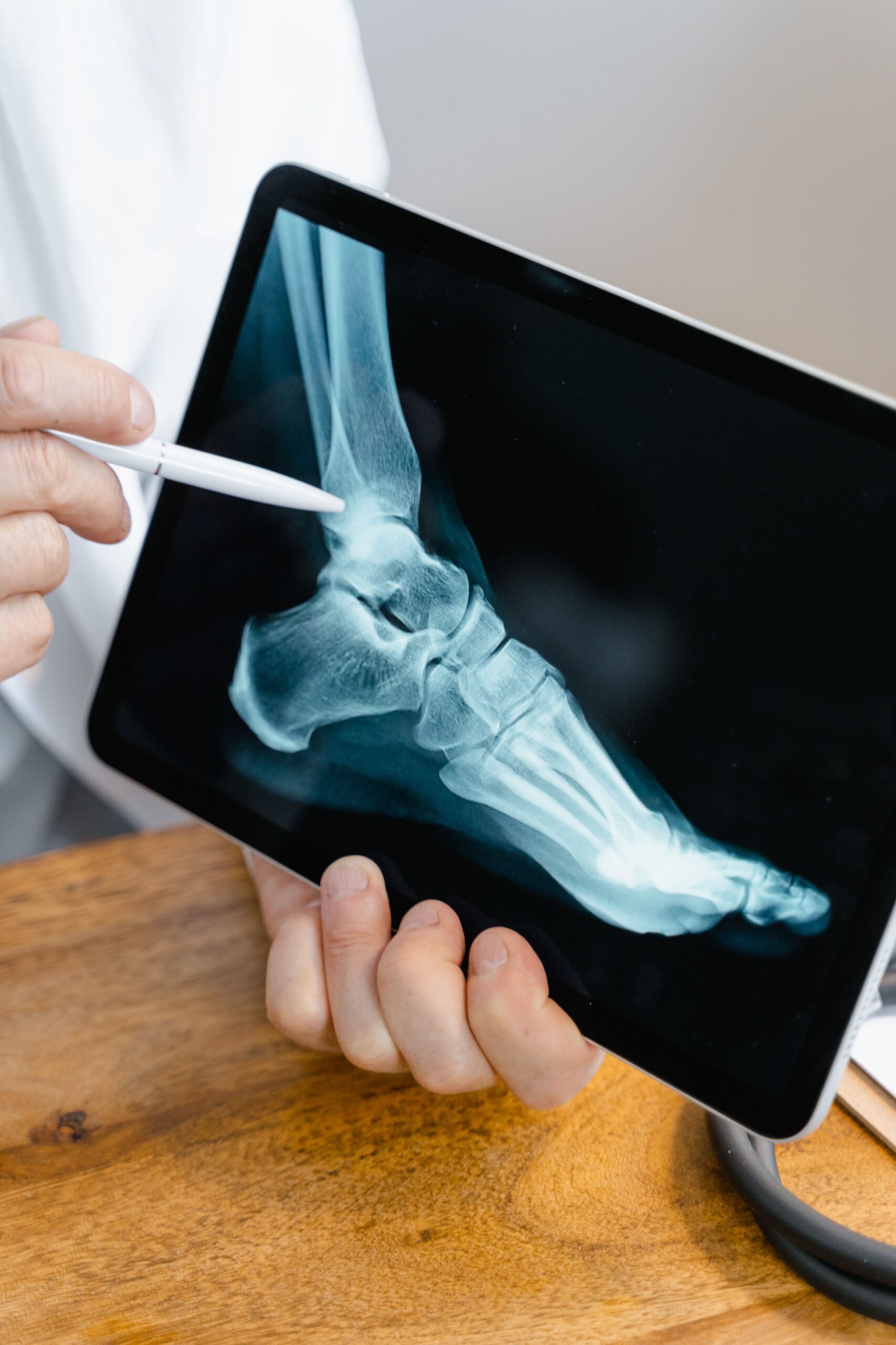 bone density